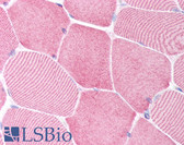 Anti-CASP6 / Caspase 6 Antibody (N-Terminus) IHC-plus LS-B1345