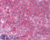 Anti-CD82 Antibody (C-Terminus) IHC-plus LS-B1346