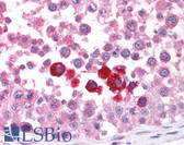 Anti-CHEK2 / CHK2 Antibody (N-Terminus) IHC-plus LS-B1348