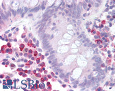Anti-MTOR Antibody (N-Terminus) IHC-plus LS-B1354