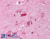 Anti-HAP1 Antibody (Internal) IHC-plus LS-B1357