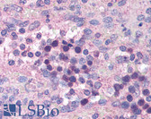 Anti-IL27RA / WSX-1 Antibody (aa611-625) IHC-plus LS-B1367