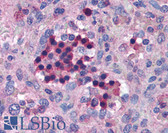 Anti-IRF7 Antibody (Internal) IHC-plus LS-B1372