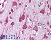 Anti-PAK7 Antibody (Internal) IHC-plus LS-B1385