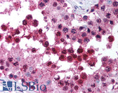 Anti-CUL9 / Cullin 9 Antibody (C-Terminus) IHC-plus LS-B1386