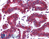 Anti-PDCD4 Antibody (C-Terminus) IHC-plus LS-B1388