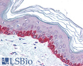 Anti-STEAP2 Antibody (C-Terminus) IHC-plus LS-B1405