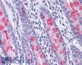 Anti-TLR1 Antibody (Internal) IHC-plus LS-B1415