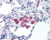 Anti-TLR5 Antibody (C-Terminus) IHC-plus LS-B1418