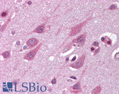 Anti-TMED10 / TMP21 Antibody (Internal) IHC-plus LS-B1422