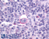 Anti-CXCR5 Antibody (C-Terminus) IHC-plus LS-A1385