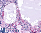 Anti-TSH Receptor / TSHR Antibody (N-Terminus) IHC-plus LS-A1445