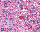 Anti-AVPR1B Antibody (N-Terminus) IHC-plus LS-A266