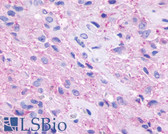 Anti-GPR148 Antibody (Cytoplasmic Domain) IHC-plus LS-A3184