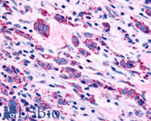 Anti-ADRA1B Antibody (Cytoplasmic Domain) IHC-plus LS-A698