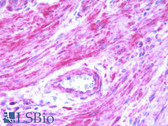 Anti-BDKRB2/Bradykinin B2 Receptor Antibody (C-Terminus) IHC-plus LS-A797