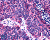 Anti-P2RY6 / P2Y6 Antibody (C-Terminus) IHC-plus LS-A877
