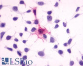 Anti-MC4R / Melanocortin 4 Receptor Antibody (N-Terminus) IHC-plus LS-A1032