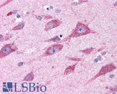 Anti-CELSR2 Antibody (N-Terminus) IHC-plus LS-A1940