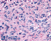 Anti-GPR139 Antibody (Cytoplasmic Domain) IHC-plus LS-A2717
