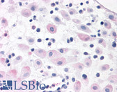 Anti-BRS3 Antibody (N-Terminus) IHC-plus LS-A4915