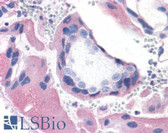 Anti-BRS3 Antibody (C-Terminus) IHC-plus LS-A5055
