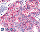 Anti-HNF4G / HNF4 Gamma Antibody (Internal) IHC-plus LS-A5162