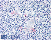 Anti-RORC / ROR Gamma Antibody (Modulating Domain) IHC-plus LS-A5188