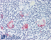 Anti-RORC / ROR Gamma Antibody (Ligand-binding Domain) IHC-plus LS-A5200