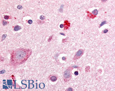 Anti-RORB / ROR Beta Antibody (Hinge Domain) IHC-plus LS-A5531