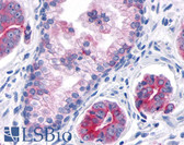 Anti-TNIK Antibody (Internal) IHC-plus LS-A7401