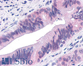 Anti-TNIK Antibody (Internal) IHC-plus LS-A7403