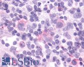 Anti-CCR9 Antibody (Cytoplasmic Domain) IHC-plus LS-A958