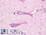 Anti-GPR19 Antibody (Cytoplasmic Domain) IHC-plus LS-A98