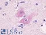 Anti-GPR37L1 Antibody (Cytoplasmic Domain) IHC-plus LS-A405