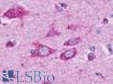 Anti-GPR37L1 Antibody (C-Terminus) IHC-plus LS-A406