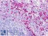 Anti-GPR152 Antibody (Cytoplasmic Domain) IHC-plus LS-A435