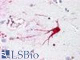 Anti-LGR6 Antibody (N-Terminus) IHC-plus LS-A442