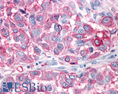 Anti-NPY1R Antibody (Cytoplasmic Domain) IHC-plus LS-A1065
