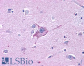 Anti-NPY5R Antibody (Cytoplasmic Domain) IHC-plus LS-A1074