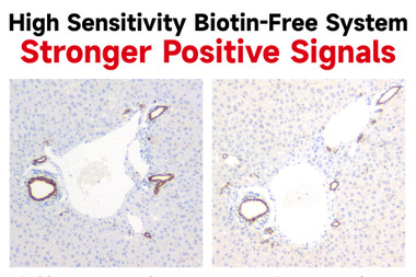 IHC-Tek Universal Anti-Mouse/Rabbit HRP Polymer Kit