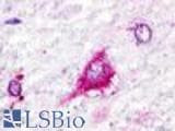 Anti-GPR22 Antibody (Cytoplasmic Domain) IHC-plus LS-A111