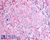 Anti-GPR45 Antibody (Cytoplasmic Domain) IHC-plus LS-A1273