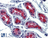 Anti-TSH Receptor / TSHR Antibody (C-Terminus) IHC-plus LS-A1450