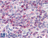Anti-Leukotriene B4 Receptor / BLT1 Antibody (Cytoplasmic Domain) IHC-plus LS-A1492