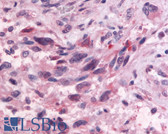 Anti-GPR83 Antibody (Cytoplasmic Domain) IHC-plus LS-A1607