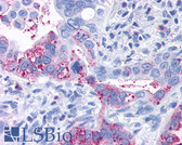 Anti-GPR6 Antibody (Cytoplasmic Domain) IHC-plus LS-A168