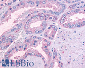 Anti-OR51E1 Antibody (Cytoplasmic Domain) IHC-plus LS-A1851