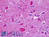 Anti-CELSR2 Antibody (N-Terminus) IHC-plus LS-A1939