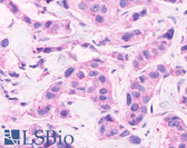 Anti-CELSR2 Antibody (C-Terminus) IHC-plus LS-A1943